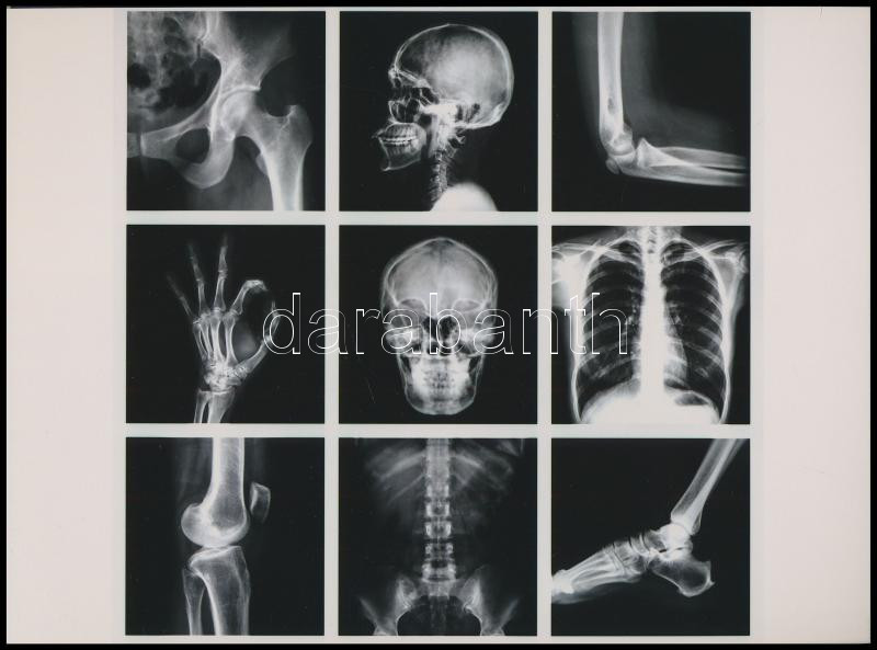 cca 1980 Röntgen felvételek tablója, 1 db mai nagyítás, 17,7x24 cm