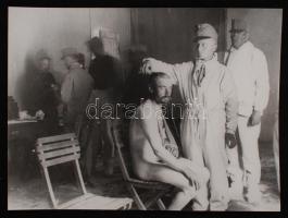 cca 1918 Katonai kórházban pucér katona ellátása, korabeli üveglemez negatívról készült későbbi nagyítás, 18x24 cm