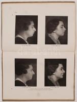 Ehrenfeld Hugó dr.: A szépítő-sebészetről. Lehetőségek, problémák, megoldások. A szerző 44 eredeti f...