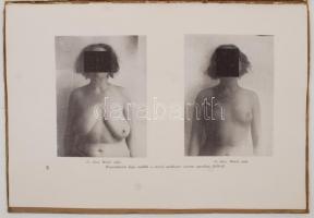 Ehrenfeld Hugó dr.: A szépítő-sebészetről. Lehetőségek, problémák, megoldások. A szerző 44 eredeti f...