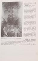 Balogh Ferenc:Urológia orvostanhallgatók és szakorvosjelöltek számára. Budapest, 1978, Medicina Köny...