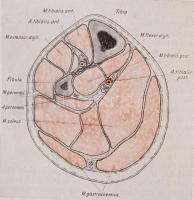 Steiner Pál: Sebészeti műtéttan. Bp., 1916, Franklin. Kicsit kopottas félvászon kötésben, egyébként ...