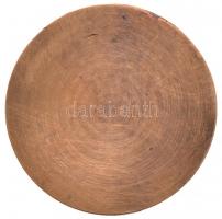 DN "Semmelweis Ignác Fülöp 1818-1865" egyoldalas Br érem (69mm) T:2