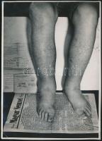 cca 1955 Tiszavölgyi József: Levelezés gyógyfürdő beutalóért, jelzés nélküli fotó a szerző hagyatékából, felületén törésnyomokkal, 18x13 cm