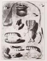 Ring, E. Malvin: Dentistry: An Illustrated History. New York,é.n.,  Abradale Press. Kiadói egészvász...