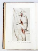 Steiner Pál: Sebészeti műtéttan. Bp., 1916, Franklin. Korabeli kopottas félbőrkötésben