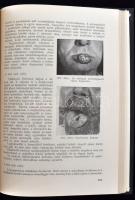 Balogh Károly: Fogászat. Bp., 1958, Medicina Könyvkiadó. Számos érdekes képillusztrációval. Vászonkö...