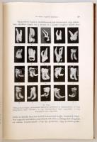 Dr. Simon Béla: A fogeltávolítás műtéttana. Budapest, 1934, Pfeiffer Ferdinánd, 253p. Kiadói egészvá...