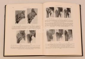 Dr. Lorenz Böhler: A csonttörések kezelése III. kötet. Budapest, 1962, Medicina Könyvkiadó. Kiadói k...