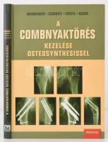 A combnyaktörés kezelése osteosynthesissel. Szerk.: Manninger Jenő et al. Bp., 2002, Medicina Könyvkiadó Rt. Manninger Jenő (1918-2008) orvos, baleseti sebész aláírásával! Kartonált papírkötésben, jó állapotban.