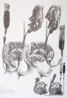 Muhari-Papp Sándor Balázs - Csókay András: Művészet és idegsebészet együtt a hitben. / Art and Neuro...