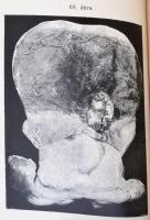 Dr. Hoffmann E. Lovag: A törvényszéki orvostan atlasza. Lehmann-féle orvosi kézi atlaszok IX. Fordít...