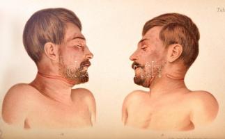 Dr. Hoffmann E. Lovag: A törvényszéki orvostan atlasza. Lehmann-féle orvosi kézi atlaszok IX. Fordít...