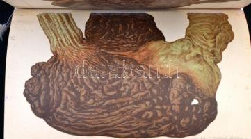 Dr. Hoffmann E. Lovag: A törvényszéki orvostan atlasza. Lehmann-féle orvosi kézi atlaszok IX. Fordít...