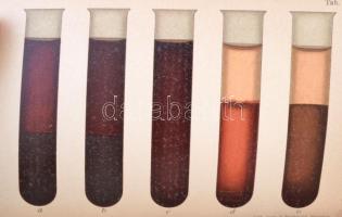 Dr. Hoffmann E. Lovag: A törvényszéki orvostan atlasza. Lehmann-féle orvosi kézi atlaszok IX. Fordít...