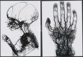 cca 1910 Orvosi felvételek, érfestéssel készített röntgen fotók, 4 db korabeli vintage képről készített mai másolatok, 13x18 cm