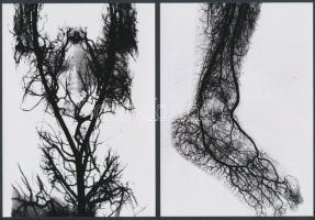 cca 1910 Orvosi felvételek, érfestéssel készített röntgen fotók, 4 db korabeli vintage képről készít...