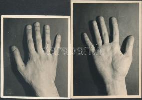 cca 1931 Kinszki Imre (1901-1945): Kezek, 2 db jelzés nélküli vintage fotó a szerző hagyatékából, 6x7 cm és 6x8,4 cm