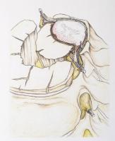 Muhari-Papp Sándor Balázs - Csókay András: Művészet és idegsebészet együtt a hitben. / Art and Neuro...