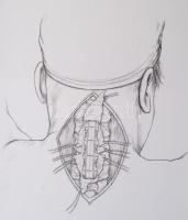 Muhari-Papp Sándor Balázs - Csókay András: Művészet és idegsebészet együtt a hitben. / Art and Neuro...