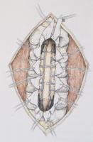 Muhari-Papp Sándor Balázs - Csókay András: Művészet és idegsebészet együtt a hitben. / Art and Neuro...