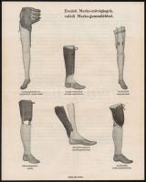 cca 1910 Szikla D. orvos-sebészeti műszer és kötszergyáros cég A. A. Marks-féle művégtag prospektusa