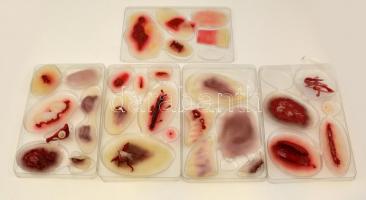 Műanyag sebkollekció, 30 db, saját dobozában, leírással