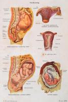 Fischer-Dückelmann: A nő mint háziorvos. 1-2. köt. Bp., é. n., Révai. Kissé megviselt vászonkötésben