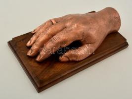 Azonosítatlan híres ember jobb kézfeje, galvanoplasztika, fa talapzaton, jelzett (Der Galvanoplastik, J. Husza Wien), tisztított, 21,5×12×7,5 cm