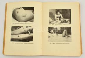 Mérgezések mérgezettek ápolása. Bp., 1953, Belügyminisztérium és Egészségügyi Minisztérium. Papírköt...