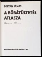 Zoltán János: A bőrátültetés atlasza. Bp., 1984, Medicina. Vászonkötésben, papír védőborítóval, jó á...