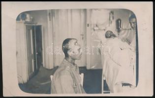 cca 1916 Hihetetlen katonai fejsérülés, 2 db fotólap, 14×8,5 cm