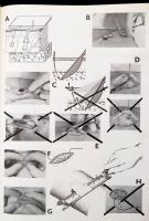 Dr. Zoltán János: Cicatrix Optima. Az ideális sebgyógyulás műtéttana. Bp.,1974, Medicina. Kiadói egé...