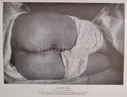 dr. Ernst Schertel: Der Erotische Komplex. Berlin, é.n. Pergamon. 303p. Kiadói papírborítékban. Reng...