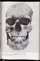 Kiszely István: Sírok, csontok, emberek. Embertan a régészetben. Bp., 1969, Gondolat. Első kiadás. K...