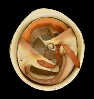 Magyar Néphadsereg katonai rendész sisak, kopott, kissé sérült, 26x23x13 cm