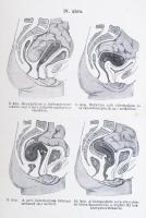 2 orvosi könyv: Schäffer Oszkár: A női betegségek okai és elkerülésük módjai 21 ábrával. Bp., é.n. L...