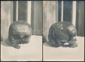1910/1918 Cillei Ulrik (1406-1456) gróf, horvát-szlavón bán, a Cillei-család utolsó tagjának koponyája elől- és oldalnézetből készült fotókon, rajta a Hunyadi László barátai által okozott sérülésekkel, a fotók 1918-ban készültek, hátoldalon feliratozva, 15×10 cm, hozzá tartozik egy német nyelvű kiadvány a celjei Mária-templomról, ahol a koponyát őrizték, Baróti Lajos irodalomtörténész és kutató ceruzás megjegyzéseivel, 13p