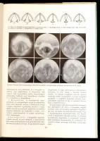 Molnár József: A magyar beszédhangok atlasza. Bp., 1973, Tankönyvkiadó. Második kiadás. Kiadói egész...