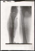 cca 1930 Orvosi röntgenfelvételek, 8 db vintage negatív Fekete György (1904-1990) budapesti fényképész hagyatékából, 3x3,7 cm
