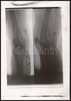cca 1930 Orvosi röntgenfelvételek, 8 db vintage negatív Fekete György (1904-1990) budapesti fényképé...
