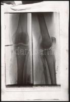 cca 1930 Orvosi röntgenfelvételek, 8 db vintage negatív Fekete György (1904-1990) budapesti fényképé...