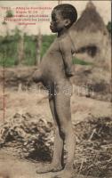African boy with exuberant stomach