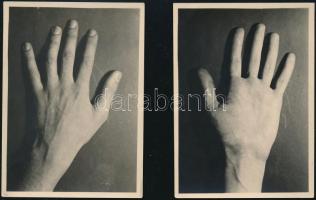 cca 1934 Kinszki Imre (1901-1945) budapesti fotóművész hagyatékából 2 db aláírással jelzett vintage fotó (Tenyér és kézfej), 6,1x8,5 cm