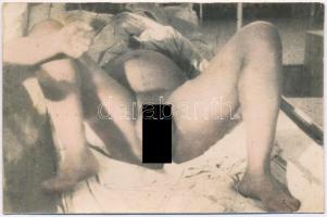 A szülés pillanata / The moment of childbirth. Original vintage photo postcard (ragasztónyom / gluemark)