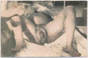 A szülés pillanata / The moment of childbirth. Original vintage photo postcard (ragasztónyom / gluem...
