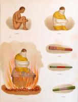 A magyar orvosok és természetvizsgálók 1874 aug. 24-től aug. 29-ig Győrött tartott XVII-ik nagygyűlé...