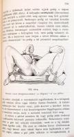 Schmid Hugó: Sebészi műtéttan. Orvostanhallgatók és gyakorló-orvosok számára. Bp., 1891., Grimm Gusz...