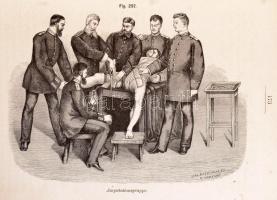 [Friedrich von Esmarch (1823-1908)]: Dr. Friedrich Esmarch: Handbuch der Kriegschirurgischen Technik...