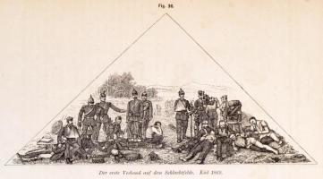 [Friedrich von Esmarch (1823-1908)]: Dr. Friedrich Esmarch: Handbuch der Kriegschirurgischen Technik...
